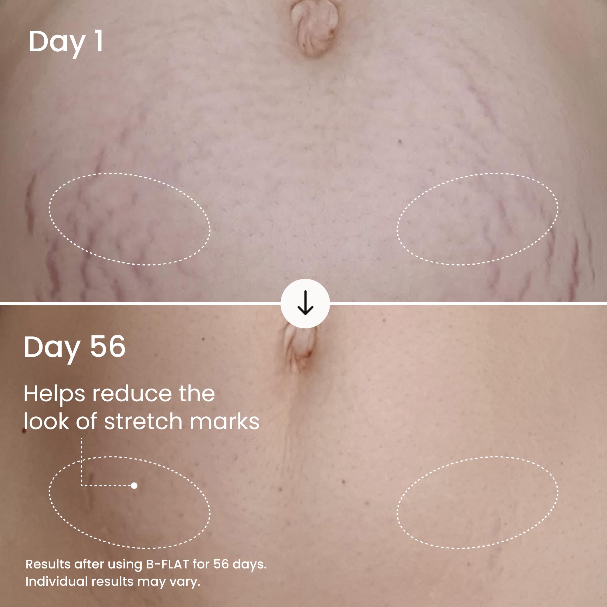 MAËLYS Body Firming Bundle - B-TIGHT Lift & Firm Booty Mask - B-FLAT Belly Firming Body Cream - B-PERKY Lift & Firm Boob Mask - Body Care Set - Image 3