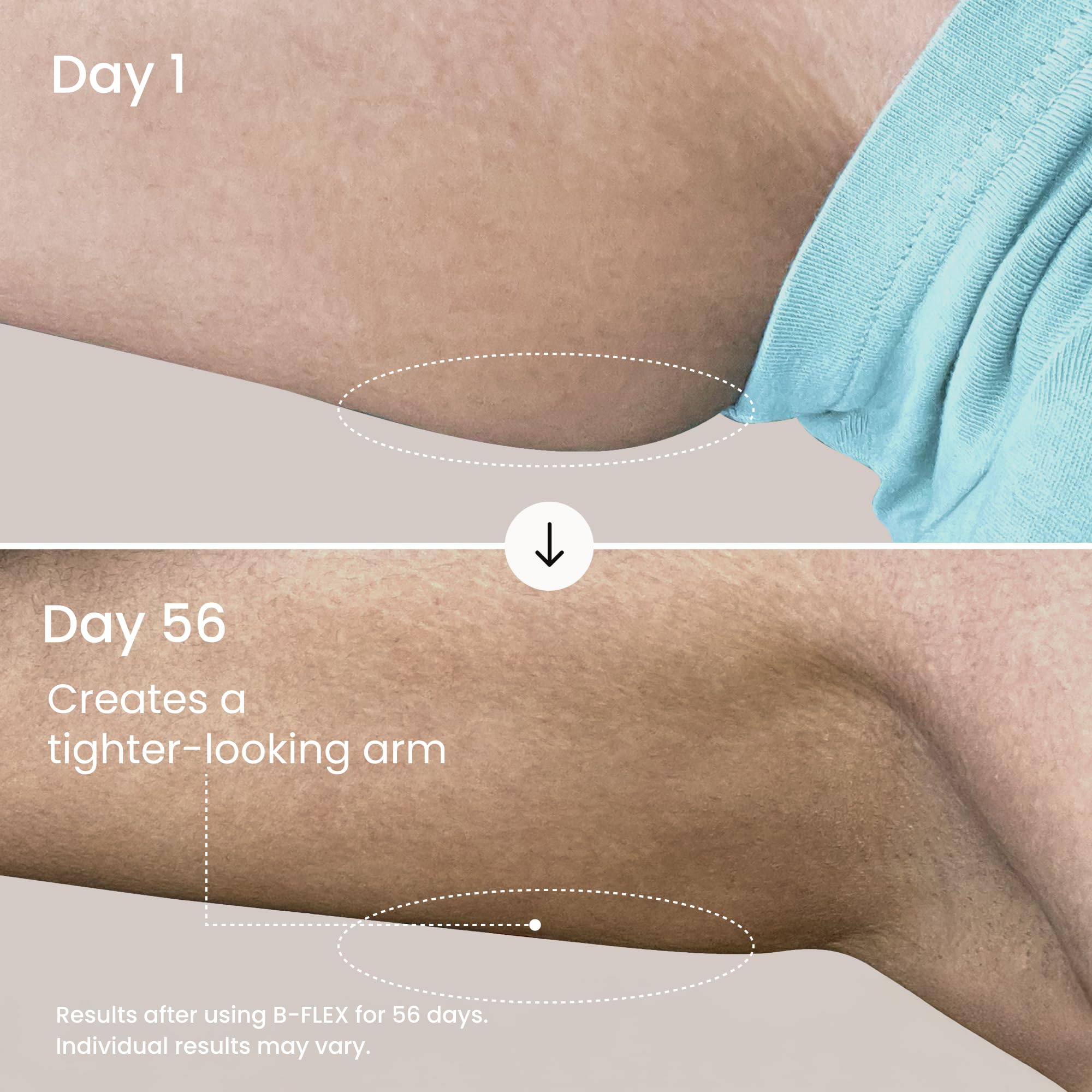 MAËLYS Body Tightening Bundle - B-FLEX Firming Arm Cream - B-FLAT Belly Firming Body Cream - B-TIGHT Lift & Firm Booty Mask - Body Care Set - Image 3