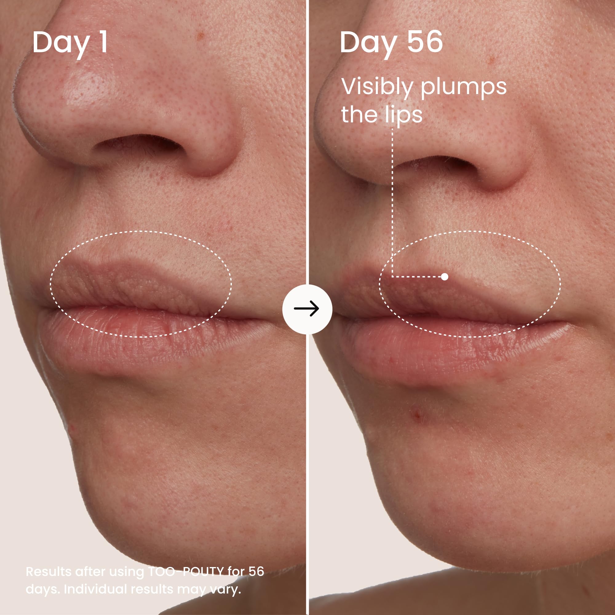 MAËLYS TOO-POUTY Lip Plumping Mask - Dual-Use Lip Treatment and Primer - Visibly Smooths Fine Lines and Enhances Fullness (0.5 Fl Oz) - Image 3